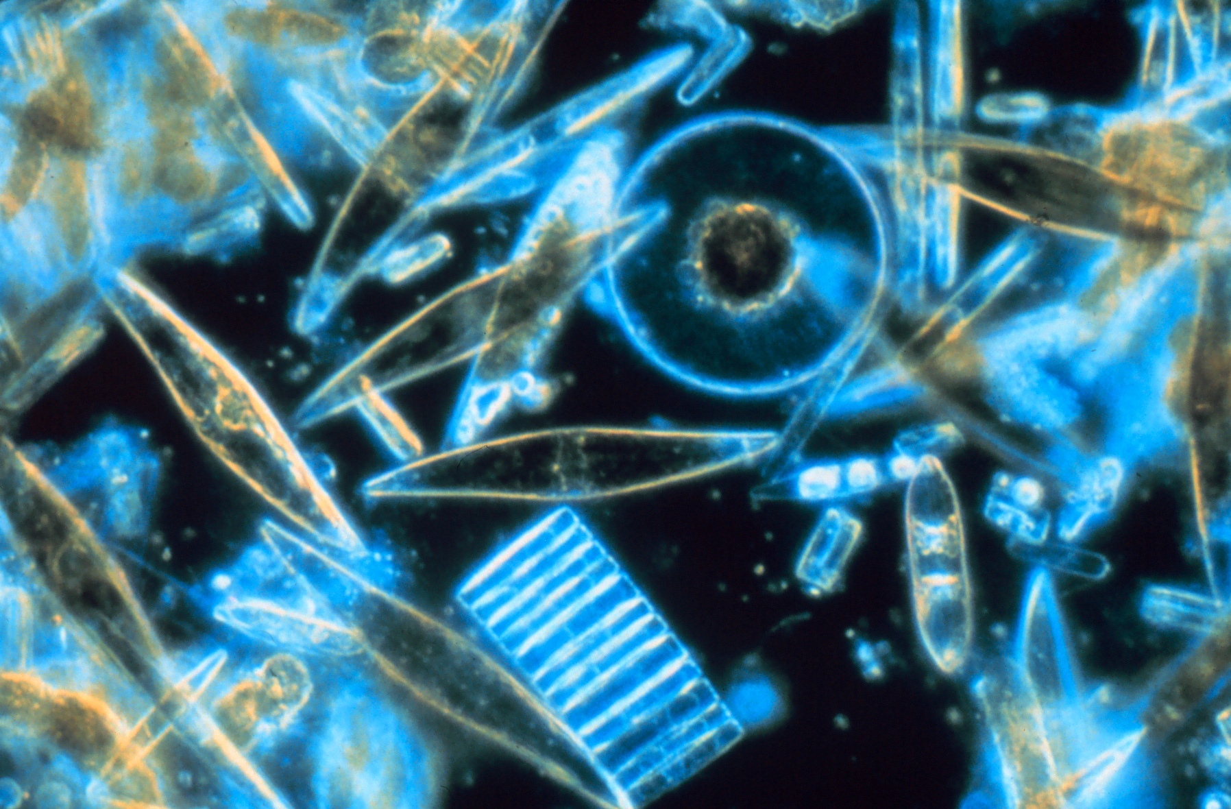 diatoms through microscope