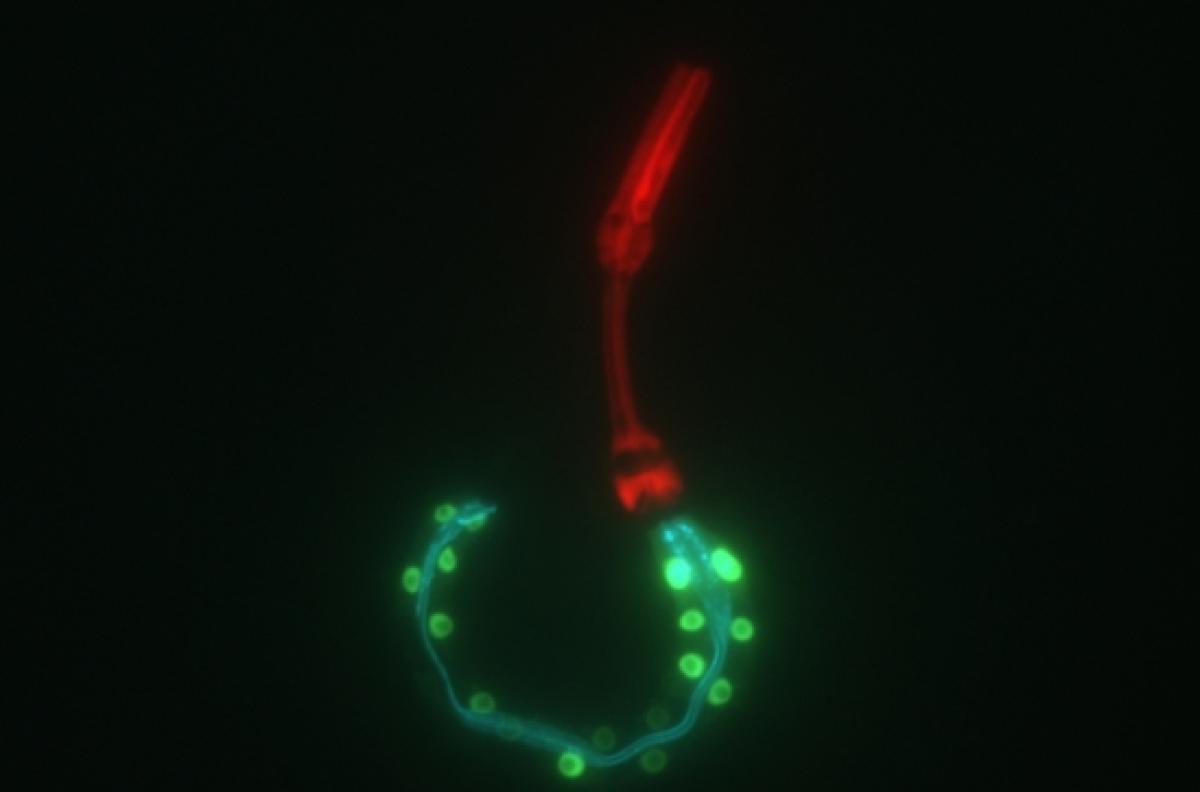 roundworm in a microscope