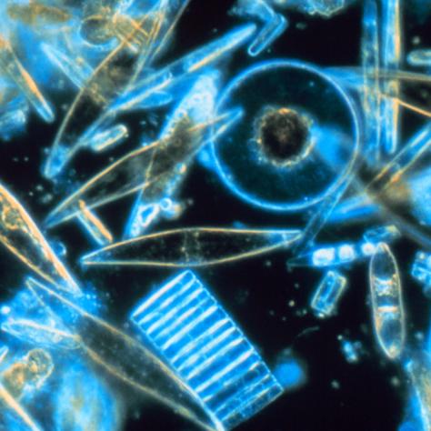 diatoms through microscope